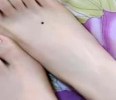 神秘的脚踝痣