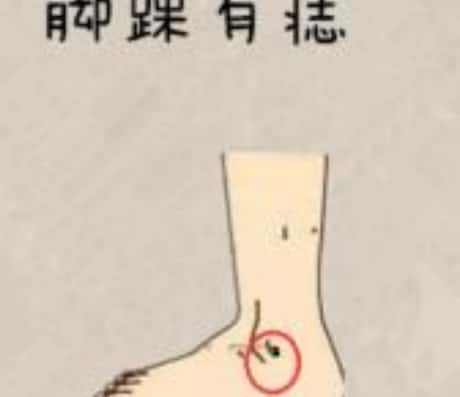 脚踝有颗痣，好不好？