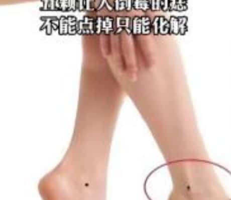 男人脚腕长痣好不好