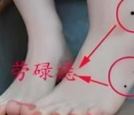 男子脚踝有痣好不好