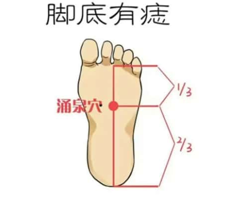 脚底长痣的位置与命运