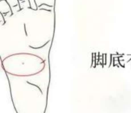 脚背长痣好不好？解读身体痣相之谜