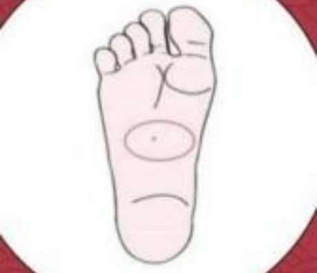 脚底有痣的女人是什么意思