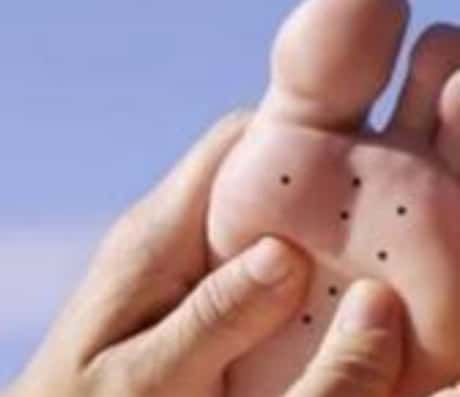 女人脚长痣好不好