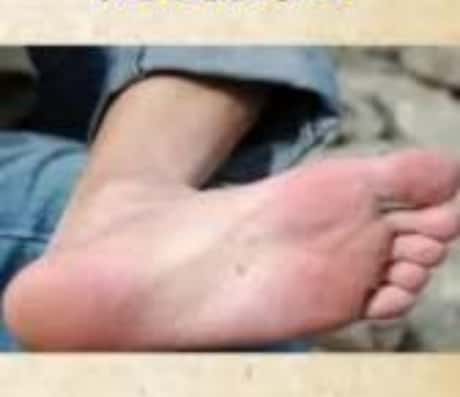 脚底长痣的说法与解读