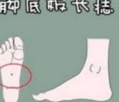 女人面部痣好坏一览表