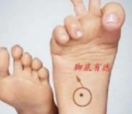 脚底长痣在女性身上的含义
