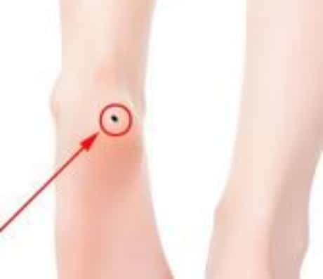 脚踝有痣的人代表什么