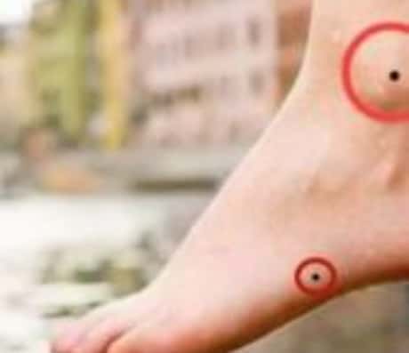 脚踝上一寸有痣，寓意何在？