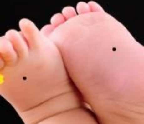 脚心有个痣代表什么