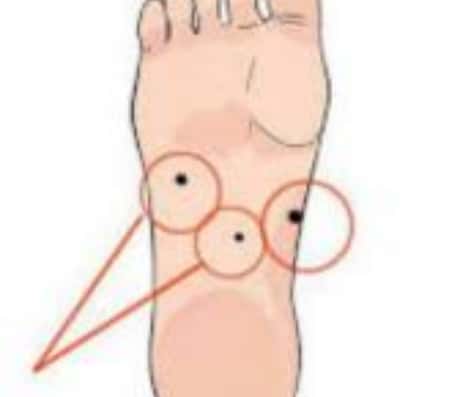 男孩子右脚心痣的神秘寓意