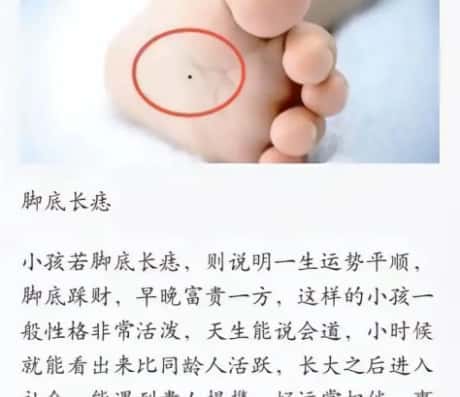 女生右脚心长痣好不好