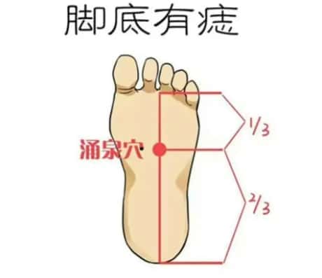 脚底有痣财运好不好的解读